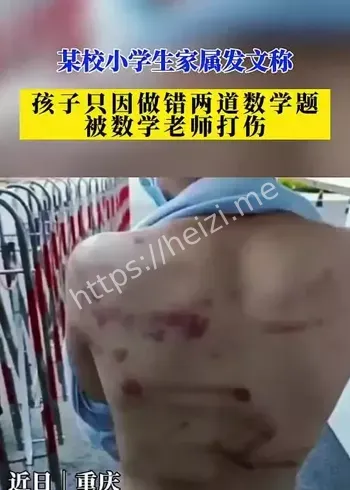 校内驾车撞伤学生通报